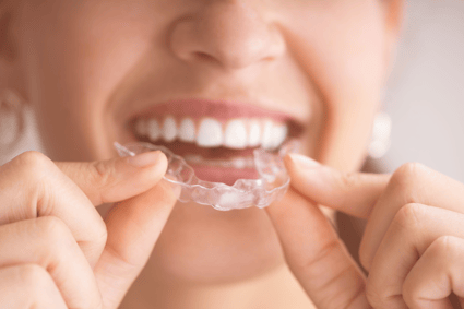 Is Smile Direct Club the Same Thing as Invisalign?