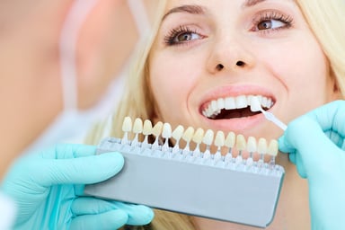 Which Teeth Whitening Method Should You Choose?